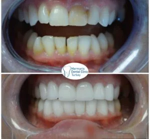 Dt. Şule Dülger smile gallery