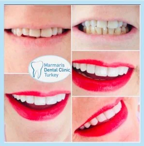 Dt. Şule Dülger smile gallery