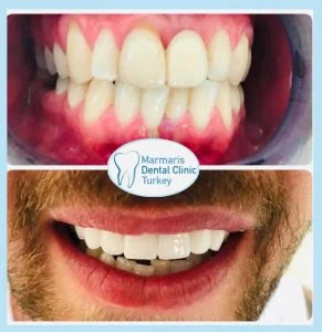 Dt. Şule Dülger smile gallery
