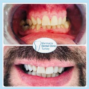 Dt. Şule Dülger smile gallery