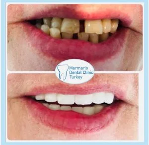 Dt. Şule Dülger smile gallery