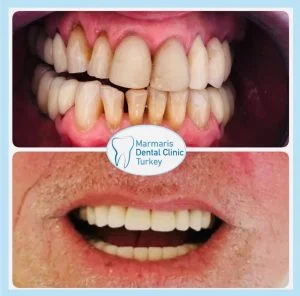 Dt. Şule Dülger smile gallery
