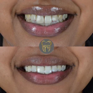 Dt. Şule Dülger smile gallery