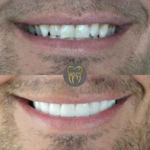 Dt. Şule Dülger smile gallery