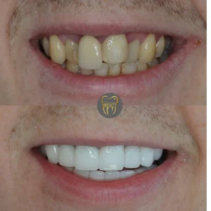 Dt. Şule Dülger smile gallery