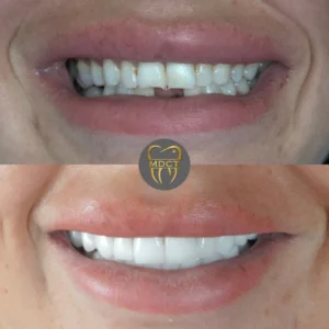Dt. Şule Dülger smile gallery