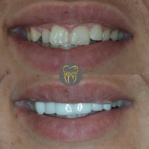 Dt. Şule Dülger smile gallery