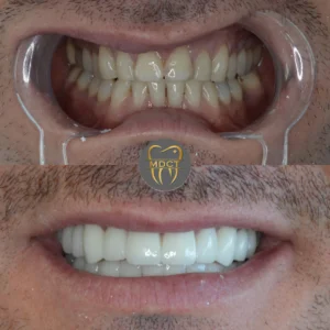 Dt. Şule Dülger smile gallery