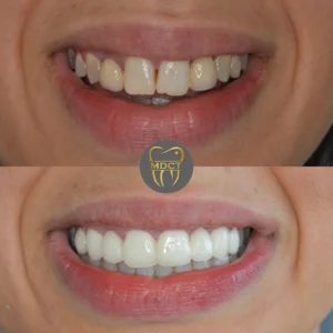 Dt. Şule Dülger smile gallery