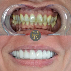 Dt. Şule Dülger smile gallery