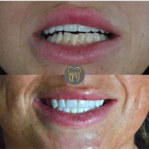 Dt. Şule Dülger smile gallery