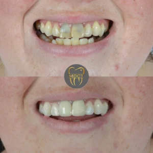 Dt. Şule Dülger smile gallery