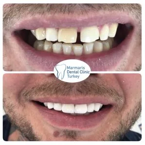 Dt. Şule Dülger smile gallery