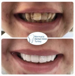 Dt. Şule Dülger smile gallery
