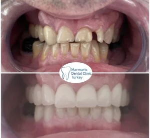 Dt. Şule Dülger smile gallery