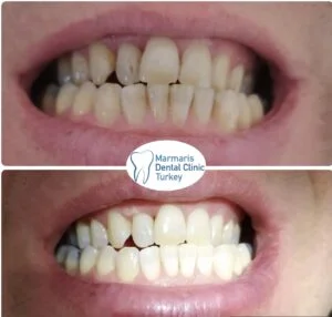 Dt. Şule Dülger smile gallery