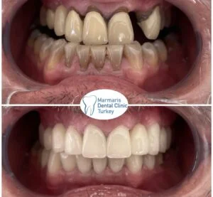 Dt. Şule Dülger smile gallery