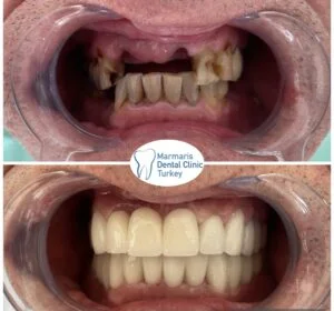 Dt. Şule Dülger smile gallery