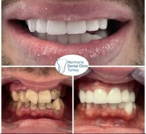 Dt. Şule Dülger smile gallery