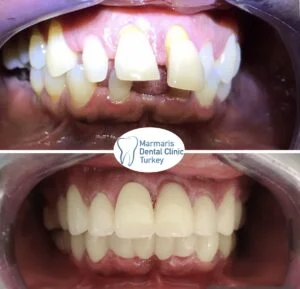 Dt. Şule Dülger smile gallery