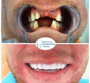 Dt. Şule Dülger smile gallery