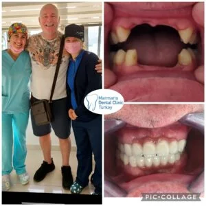 Dt. Şule Dülger smile gallery