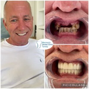 Dt. Şule Dülger smile gallery