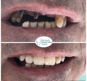 Dt. Şule Dülger smile gallery