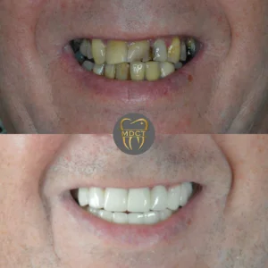 Dt. Şule Dülger smile gallery