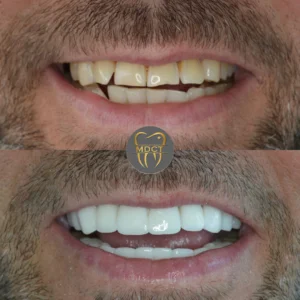 Dt. Şule Dülger smile gallery