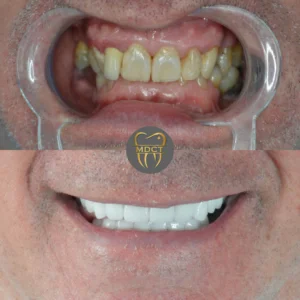 Dt. Şule Dülger smile gallery