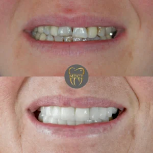 Dt. Şule Dülger smile gallery