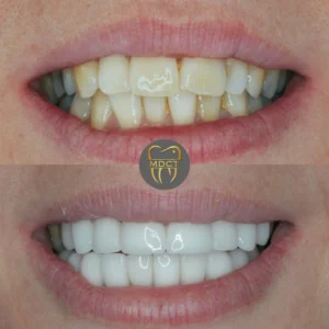 Dt. Şule Dülger smile gallery