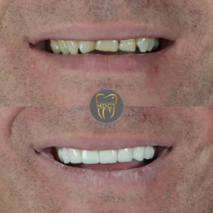Dt. Şule Dülger smile gallery