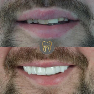 Dt. Şule Dülger smile gallery