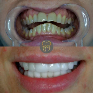 Dt. Şule Dülger smile gallery