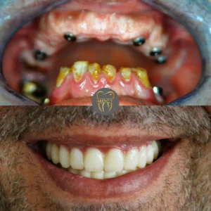 Dt. Şule Dülger smile gallery