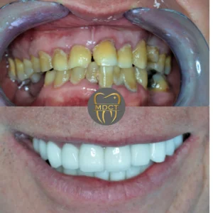 Dt. Şule Dülger smile gallery