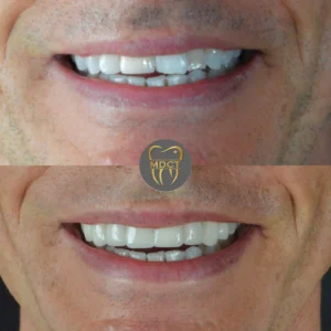 Dt. Şule Dülger smile gallery