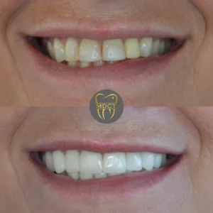 Dt. Şule Dülger smile gallery