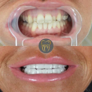 Dt. Şule Dülger smile gallery