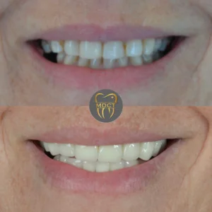 Dt. Şule Dülger smile gallery