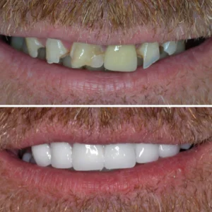 Dt. Şule Dülger smile gallery