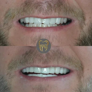 Dt. Şule Dülger smile gallery