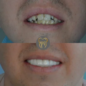 Dt. Şule Dülger smile gallery