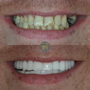 Dt. Şule Dülger smile gallery