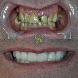 Dt. Şule Dülger smile gallery