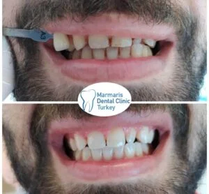 Dt. Şule Dülger smile gallery