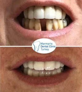 Dt. Şule Dülger smile gallery