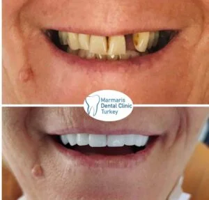 Dt. Şule Dülger smile gallery